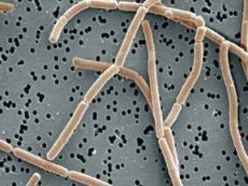Scanning electron micrograph of Lactobacillus delbrueckii subsp. bulgaricus