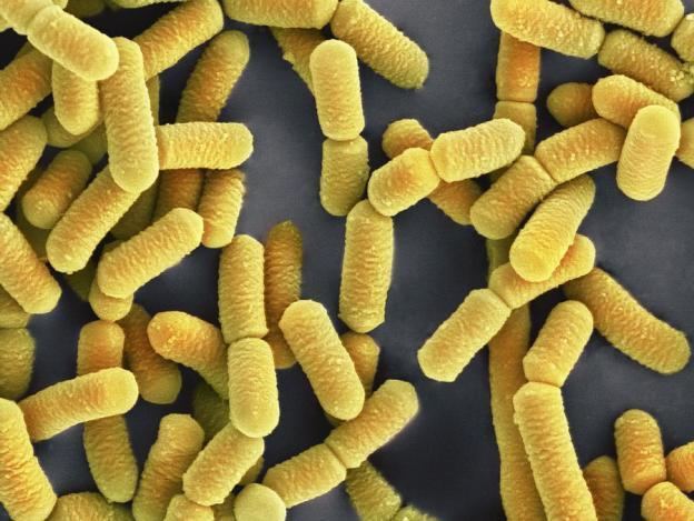 Lactobacillus Rhamnosus Alchetron The Free Social Encyclopedia Lactobacillus Rhamnosus Alchetron The Free Social Encyclopedia