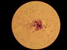 Lactococcus httpsuploadwikimediaorgwikipediacommonsthu