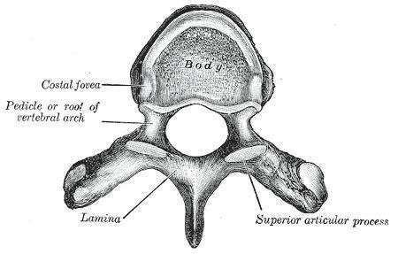 Laminectomy