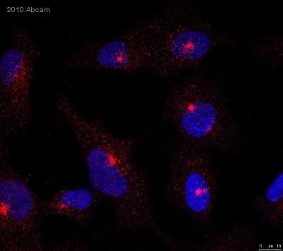 LAMP1 AntiLAMP1 antibody Lysosome Marker ab24170 Abcam