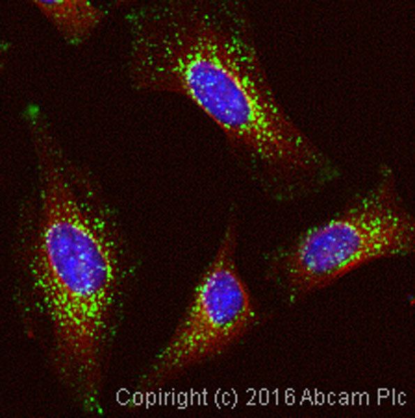 LAMP1 AntiLAMP1 antibody H4A3 ab25630 Abcam