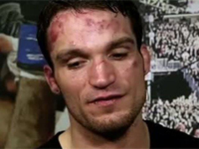Lance Benoist Lance Benoist MMA Stats Pictures News Videos Biography