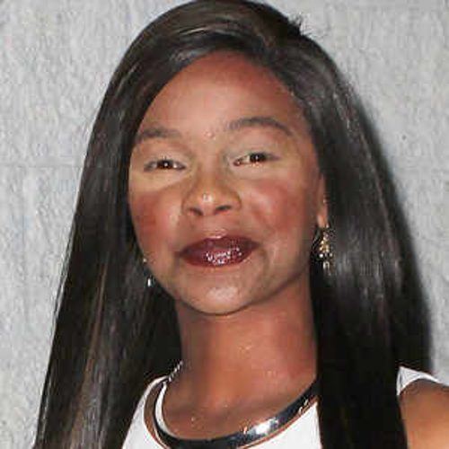 Lark Voorhies What Happened To Lisa Turtle39s Face Jim and Them