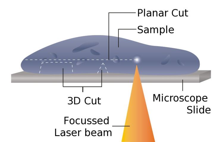 Laser microtome