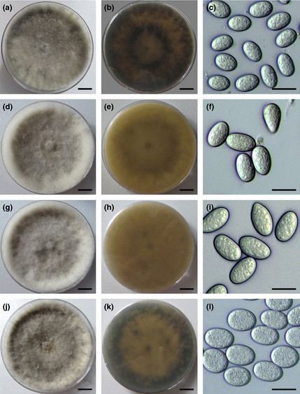 Lasiodiplodia Identification and Pathogenicity of Lasiodiplodia Species from