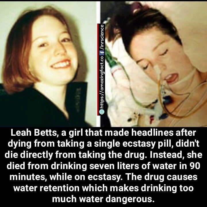 May be an image of 2 people and text that says 'inrscience E Leah Betts, a girl that made headlines after dying from taking a single ecstasy pill, didn't die directly from taking the drug. Instead, she died from drinking seven liters of water in 90 minutes, while on ecstasy. The drug causes water retention which makes drinking too much water dangerous.'