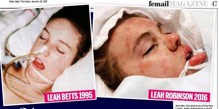 Leah Betts PressReader Daily Mail 20170119 21 years apart two girls