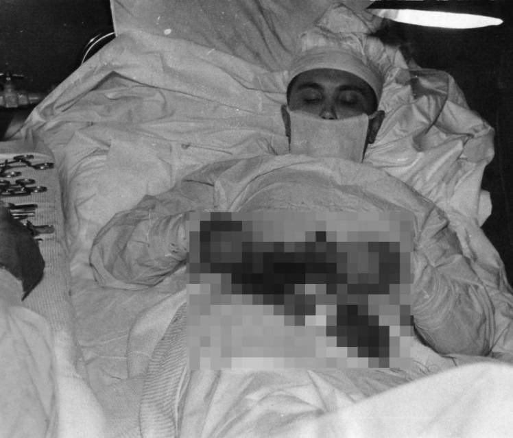 Leonid Rogozov Leonid Rogozov the Russian surgeon who removed his own