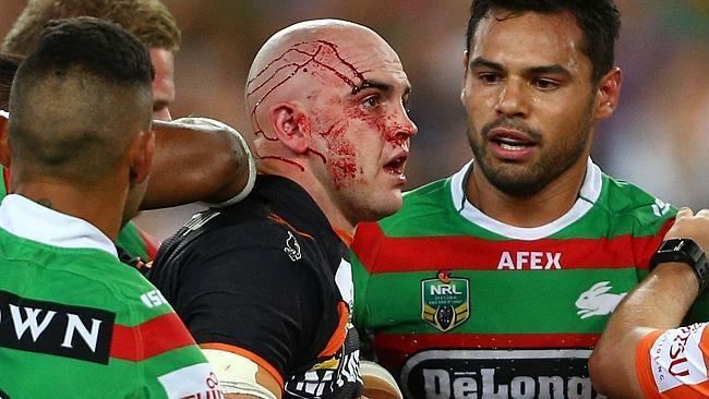 Liam Fulton The NRL has the game39s new concussion policy declaring