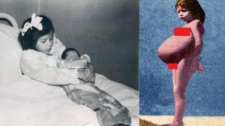 Lina Medina at age of five and her firstborn baby (picture on the left); Lina Medina while she is pregnant (picture on the right)