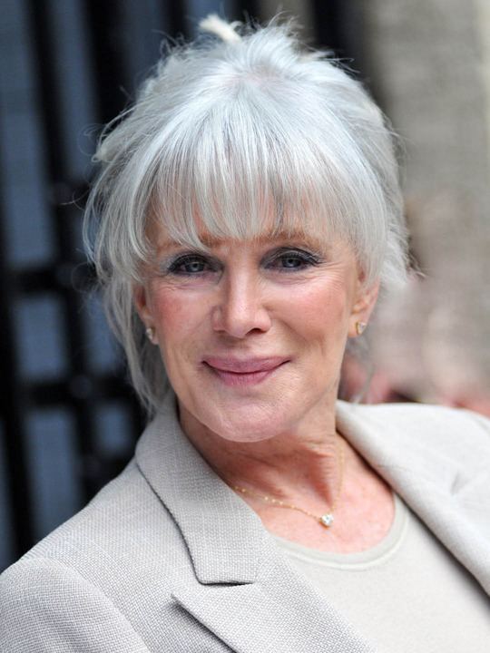 Linda Evans Linda Evans Plastic Surgery Stopping The Age In Its Tracks