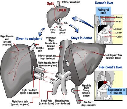 Liver transplantation Living Donor University of Illinois Hospital amp Health Sciences System