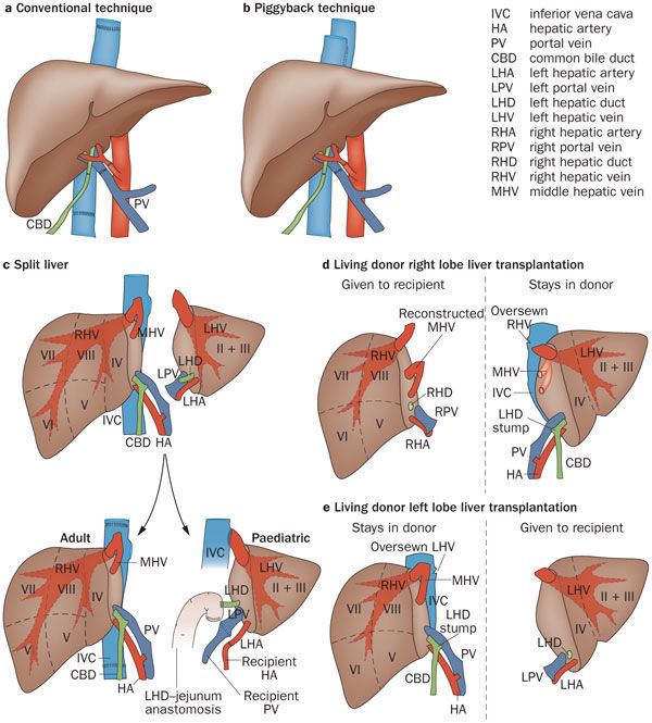 Liver transplantation Liver transplantation past present and future Article Nature