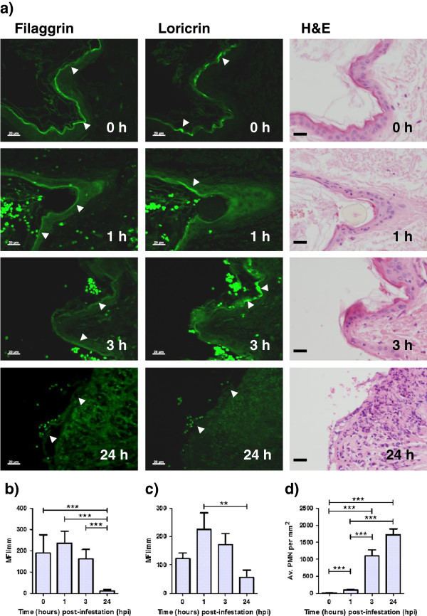 Loricrin Immunohistochemical labelling of filaggrin and loricrin and changes