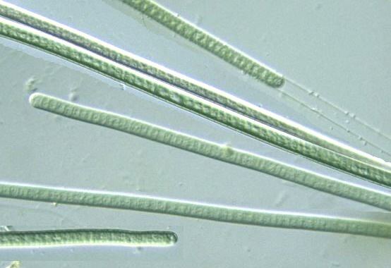 Lyngbya Prokaryote Cyanobacteria Lyngbya
