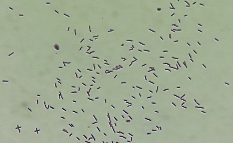 Lysinibacillus fusiformis Lysinibacillus fusiformis gram stain Gram stain of Lysinib Flickr