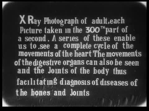 Macintyre's X-Ray Film