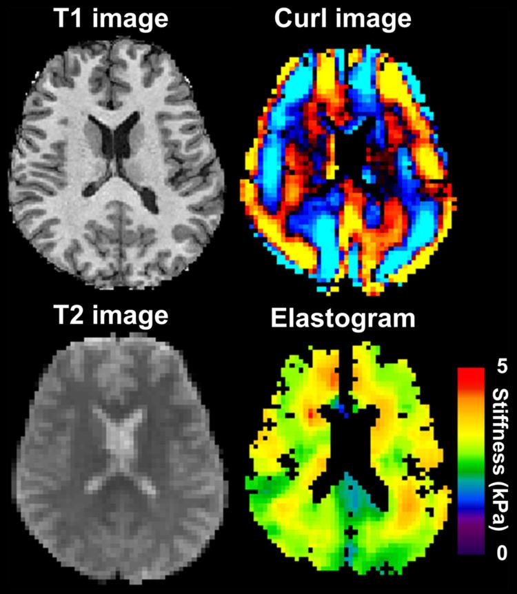 Magnetic resonance elastography