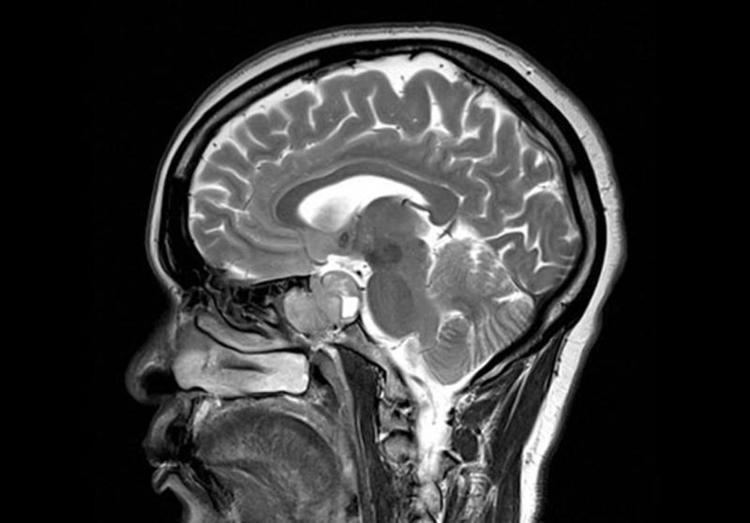 Magnetic resonance imaging of the brain Brain imaging images Big Picture