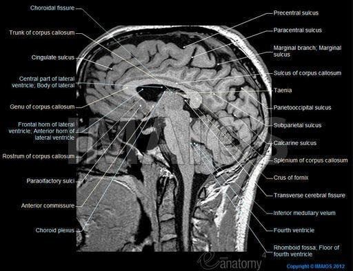 Magnetic resonance imaging of the brain Brain Atlas of human anatomy with MRI