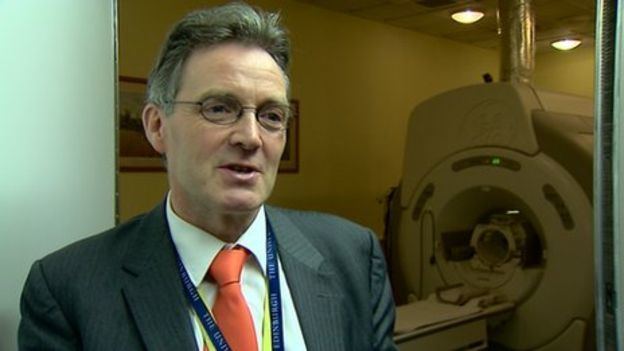 Malcolm Macleod Cap cools brain for stroke trial BBC News