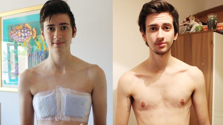 Male My Gender Transition From Female To Male Dear BuzzFeed YouTube