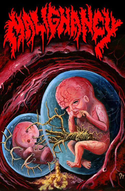 Malignancy (band) New Malignancy Shirt Design Needs Your Vote Page 2 SMNnews Forums