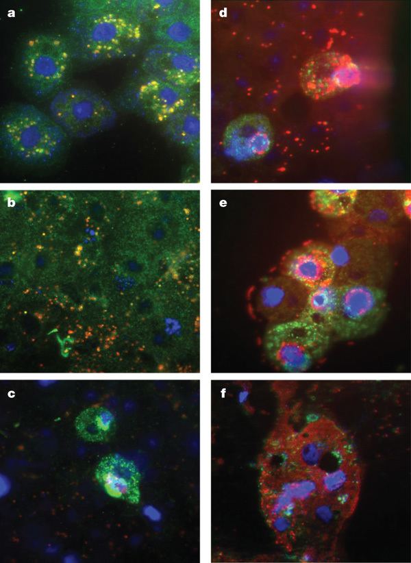 Mamavirus Sputnik propagation in mamavirusinfected amoebaeA Figure 2 of 3