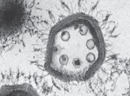 Mamavirus Sputnik the virophage a virus gets a virus Ars Technica