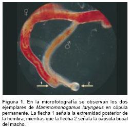 Mammomonogamus First case report of Mammomonogamus Syngamus laryngeus human