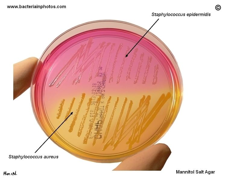 Mannitol salt agar Staphylococcus aureus and Staphylococcus epidermidis on Mannitol
