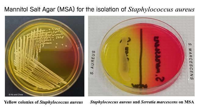 Mannitol salt agar Salt Agar for the isolation of Staphylococcus aureus