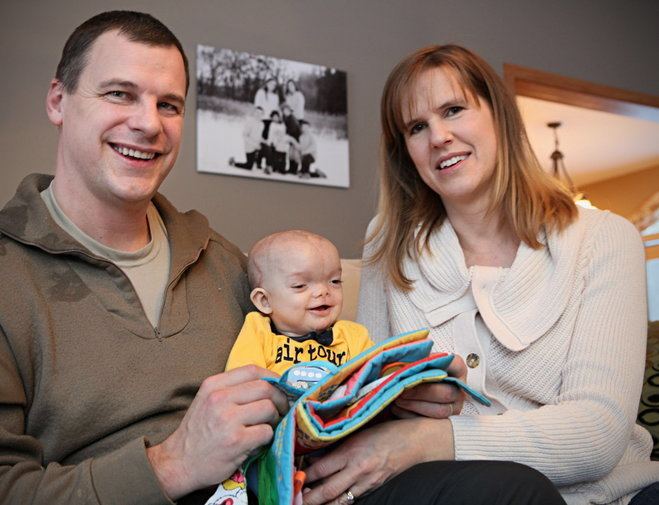 Mark Gundrum Agonizing trail leads to rare surgery for familys milliondollar baby