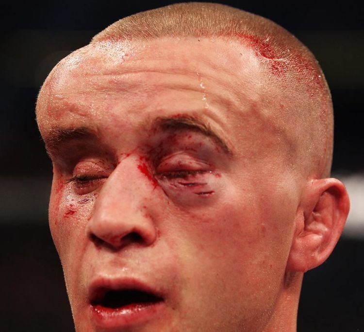 Mark Hominick Mark Hominick Nasty Face After UFC 129 Fight Pic