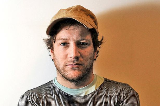 Matt Cardle Matt Cardle reveals he39s had TWO hair transplants since