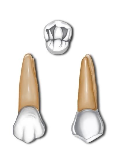 Maxillary first premolar