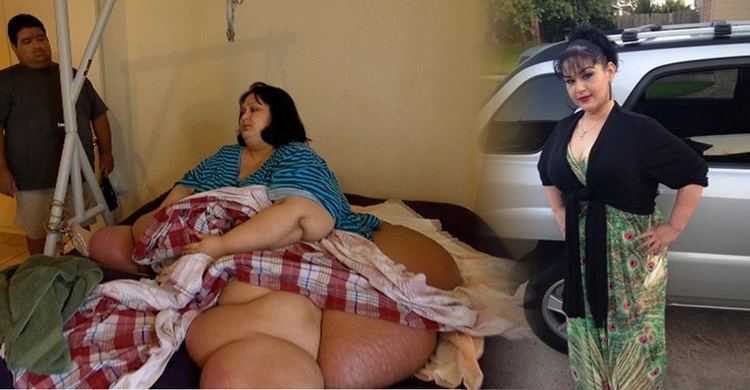 On left, Mayra Rosales sitting in her bed while she was still obese. On right, Mayra Rosales during her weight loss wearing a black and green dress.