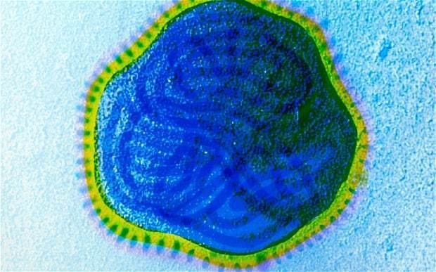 Measles virus Massive dose of measles virus kills cancer cells Telegraph