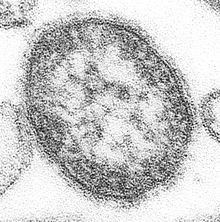 Measles virus httpsuploadwikimediaorgwikipediacommonsthu