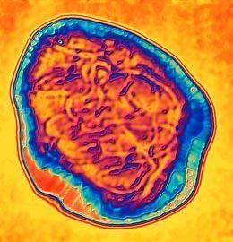 Measles virus This is a microscopic photo of the measles virus There was a recent