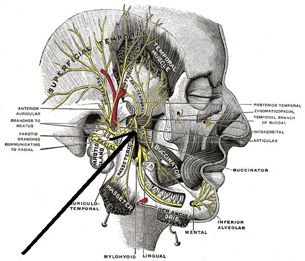 Medial pterygoid nerve