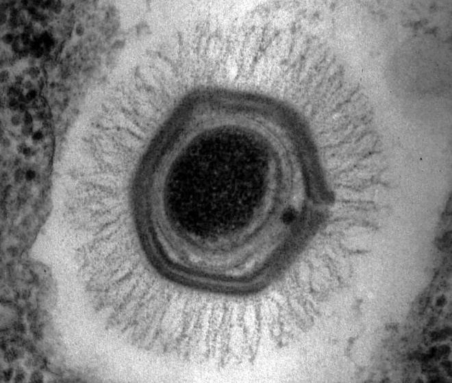 Megavirus Megavirus May Be StrippedDown Version of Normal Cell WIRED