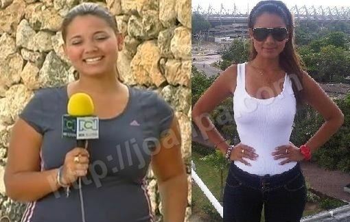 Melissa Martínez Fotos Melissa Martinez gorda Antes y Despues Deportes Patrullera