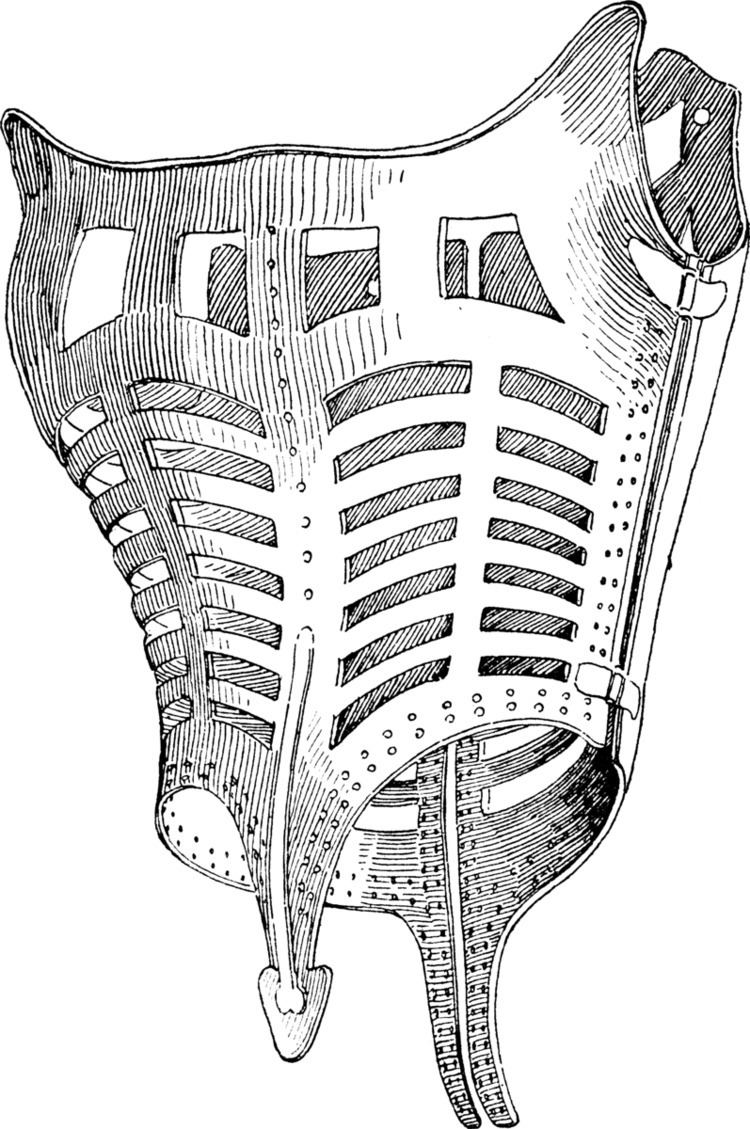 Metal corset