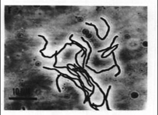 Methanobacteria webmstedumicrobioBIO2212002Methanobacterium