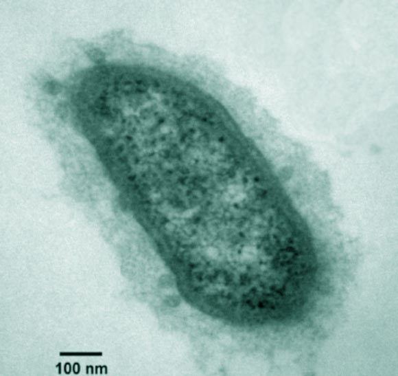 Methanobrevibacter smithii cdnscinewscomimages201303image968jpg