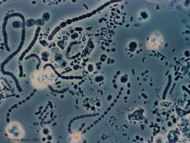 Methanogen ~ Detailed Information | Photos | Videos