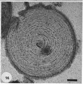 Methanosaeta Quorum Sensing in Methanosaeta harundinacea 6Ac MicrobeWiki