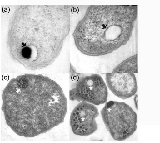 Methanosarcina acetivorans Electron micrographs thin sections of Agrobacterium tum Openi